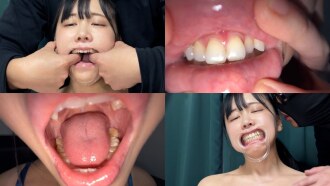 觀察鈴醬口水直流時的口腔內部。